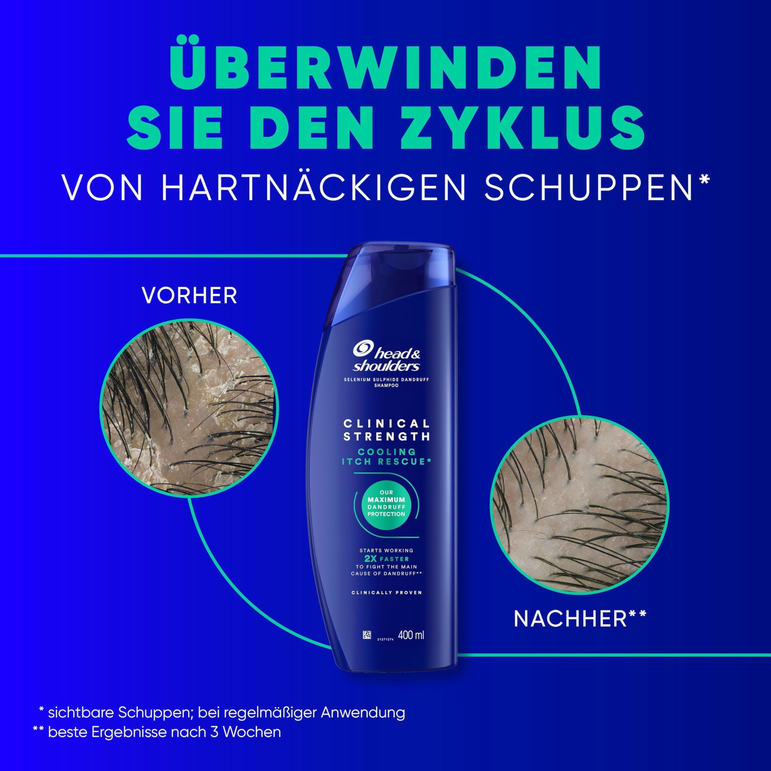Head & Shoulders Cooling Itch Rescue Anti-Schuppen Shampoo 400ml – Ansicht 3