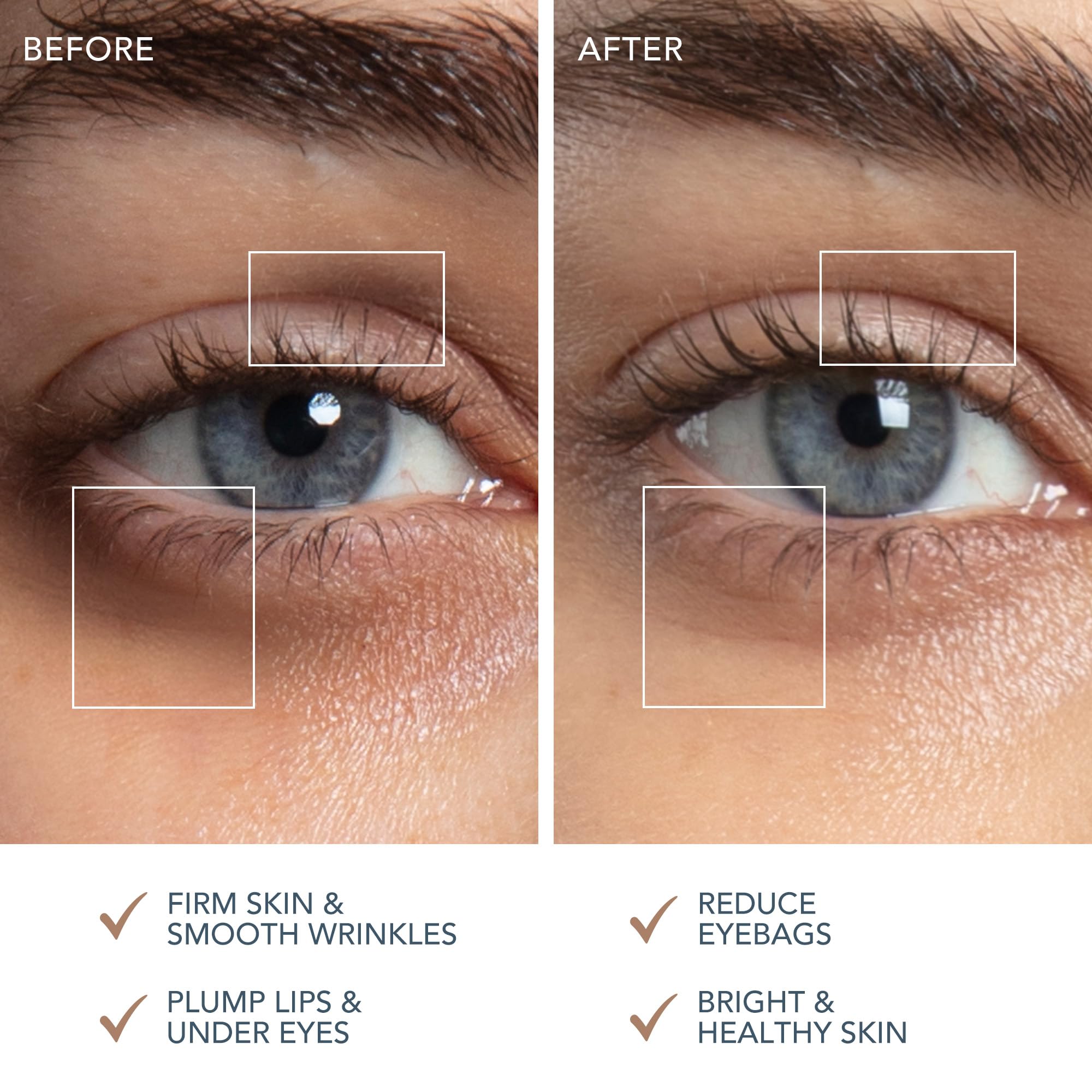 FOREO SUPERCHARGED Eye & Lip Contour Booster Serum - Conductive Gel - Niacinamide Serum - Anti Aging Serum - Lip Plumping & Puffy Eyes Treatment - Practical Travel Size - 3 x 0.12 fl.oz. Capsules