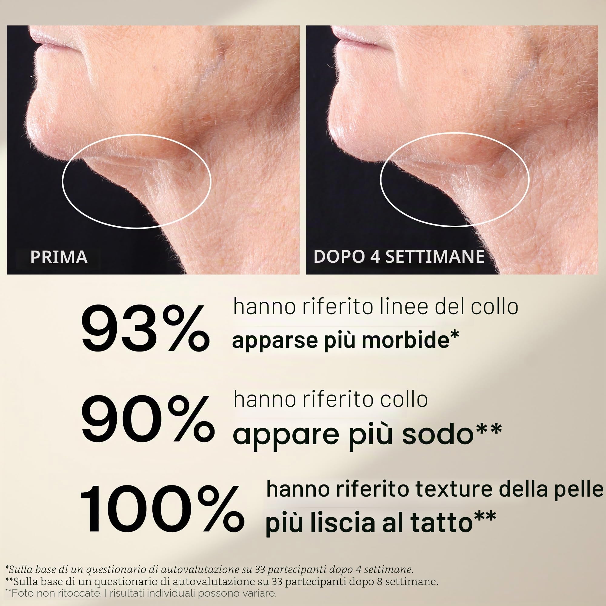 StriVectin Serrare & Lift Peptight - Rullo siero per collo serrato, 50,3 ml