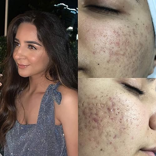 Miniatura 5 de Pro Advanced Suero de ácido hialurónico para cara, Glow+ suero antioxidante rico en proteínas con vitamina C, niacinamida y B5 para piel seca,