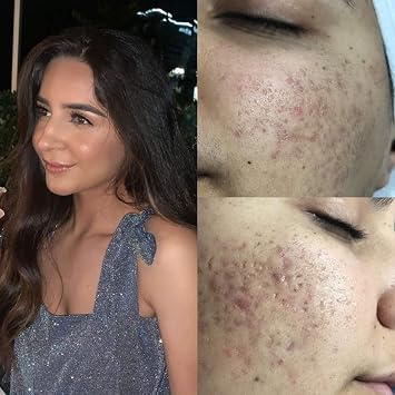 Pro Advanced Hyaluronic Acid Serum for Face, Glow+ Antioxidant Protein-Rich Face Lift Serum with Vitamin C, Niacinamide and B5 for Dry Skin Hydrating and Anti-Aging, 2oz
