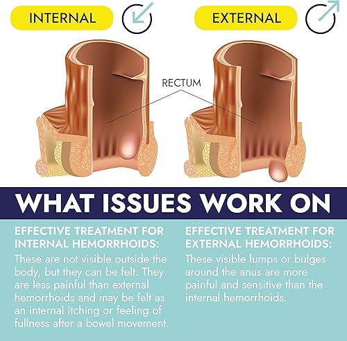 Miniatura 2 de Terramed Just Think Comfort Tratamiento de hemorroides Ungüento para hemorroides Ungüento para hemorroides y fisuras Alivio rápido y eficaz