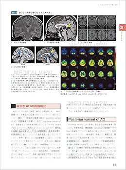 Amazon.co.jp: 画像で究める認知症 : 德丸 阿耶: Japanese Books