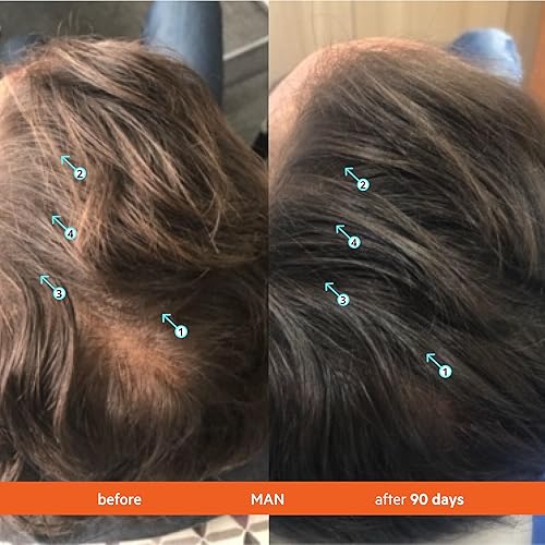 Miniatura 3 de DS Laboratories Acondicionador Revita - Tratamiento para el crecimiento del cabello fino y pérdida de cabello, acondicionador de biotina para