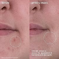 Vista 5 de Augustinus Bader The Rich Cream – Luxury Face Cream – Hydrating and Nourishing Face Moisturizer – Facial Moisturizer for Wrinkle Reduction and