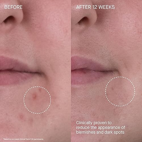 Miniatura 5 de Augustinus Bader The Rich Cream  Luxury Face Cream  Hydrating and Nourishing Face Moisturizer  Facial Moisturizer for Wrinkle Reduction and Cellular