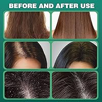 Vista 5 de 2Pcs Nature Seven Green Soap Shampoo, Nature Triangle Shampoo Bar, Polygonum Shampoos Soap, Cepress Orientalis Usman Herbal Hair Strengthening Soap