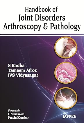 HANDBOOK OF JOINT DISORDERS ARTHROSCOPY & PATHOLOGY