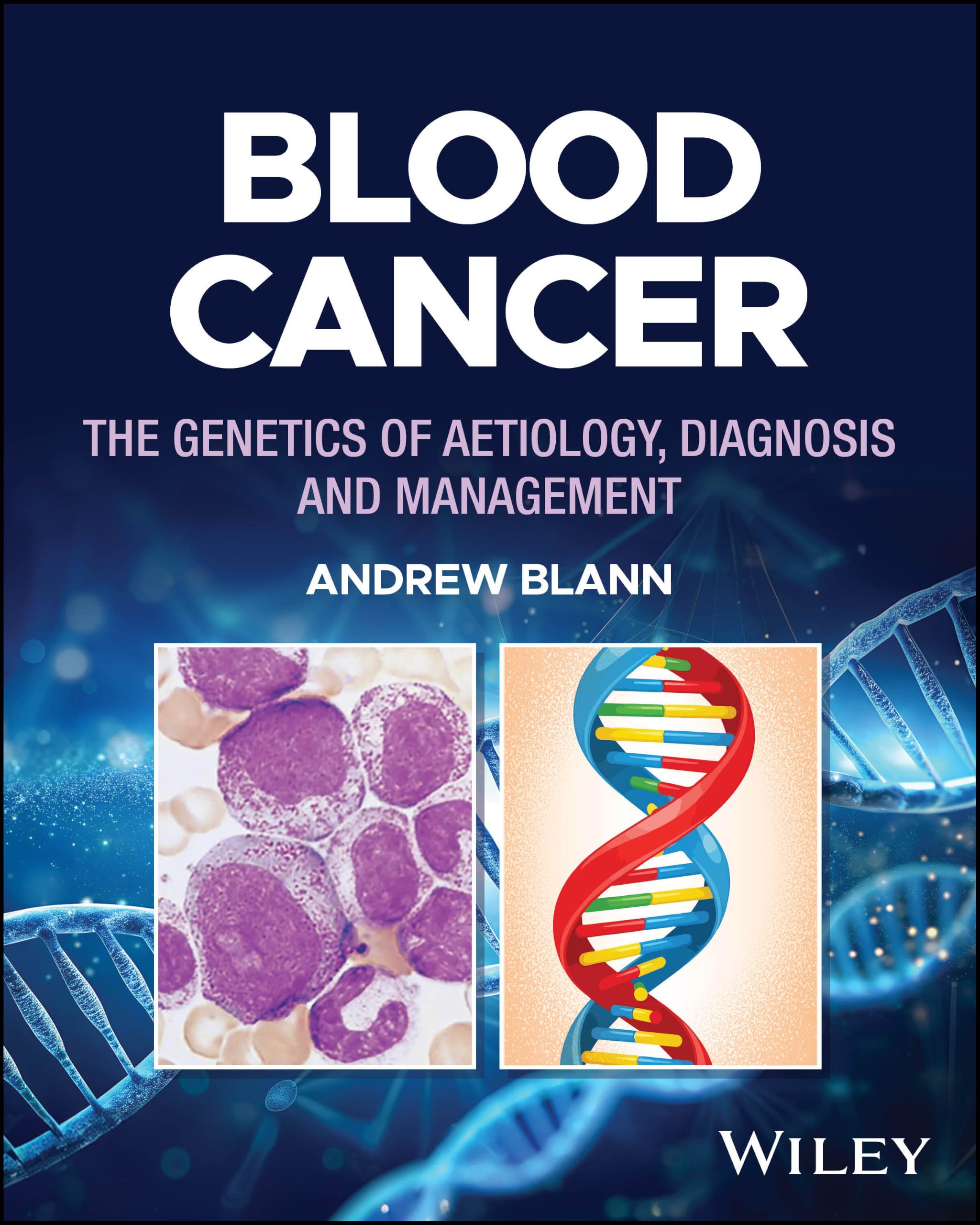 Blood Cancer: The Genetics of Aetiology, Diagnosis and Management