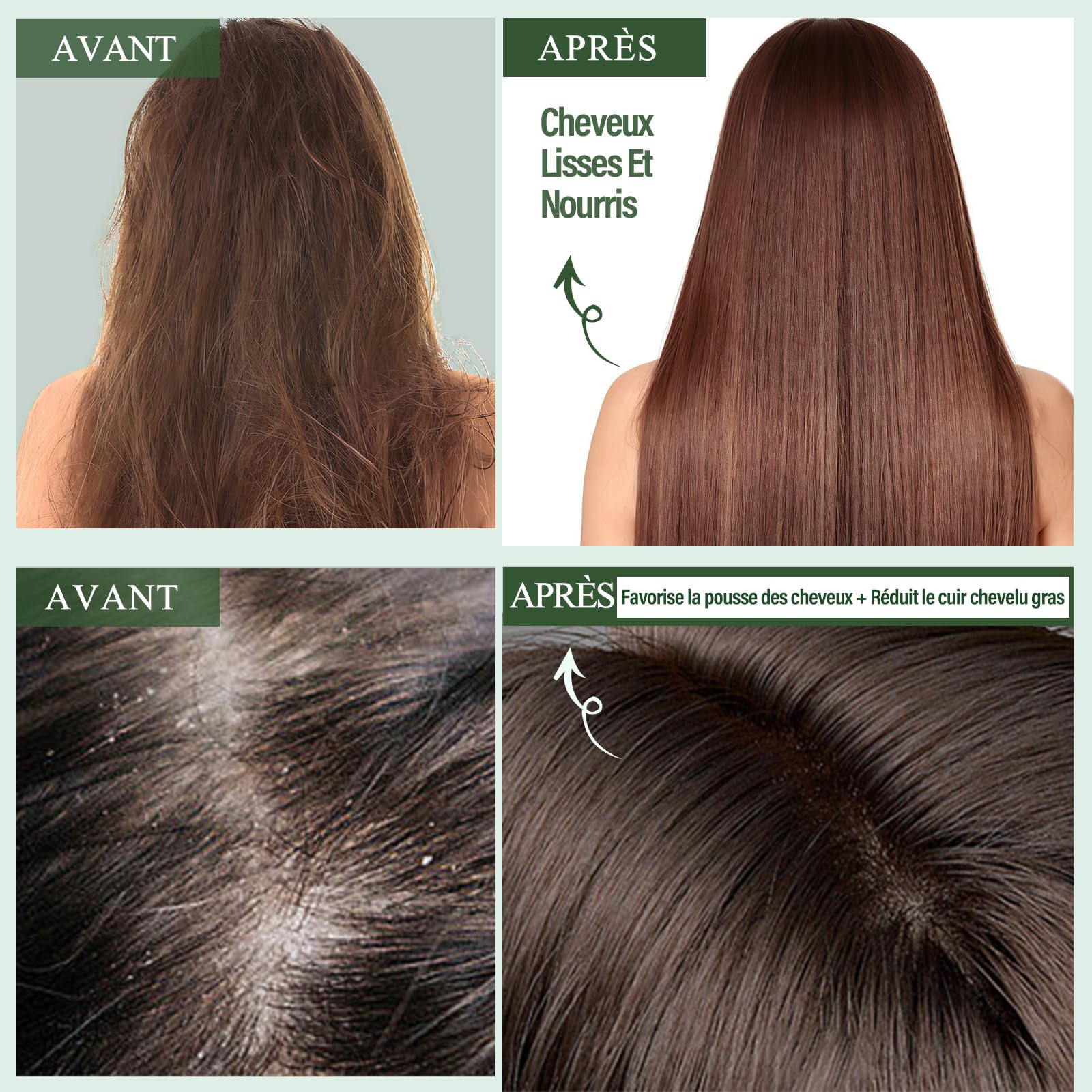 Shampooing et après-shampooing au romarin biotiné à la menthe, shampoing bio anti-chute, nettoyant et soin cuir chevelu, cadeau homme/femme