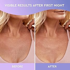 CLEVERFY Silicone Chest Anti Wrinkle Patches for Dcollet - 2-Pack of T-Shape Reusable Wrinkle Pads