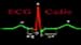 ECGCardio