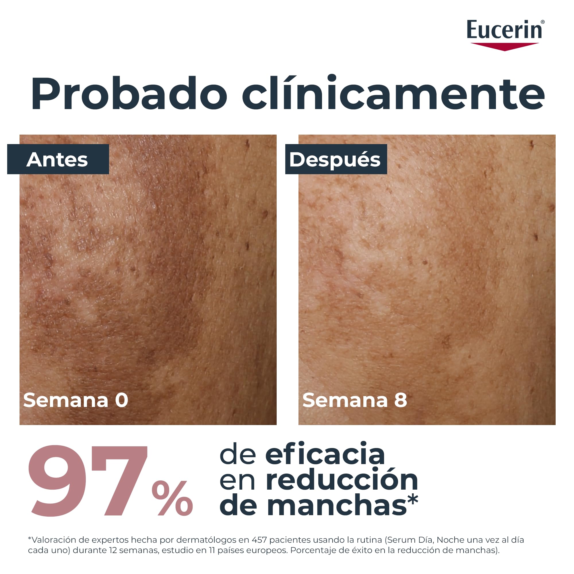 Eucerin Anti-Pigment Crema de Día con FPS 30 (50 ml), crema antimanchas para una piel más uniforme y radiante, con filtros UV y Thiamidol, hidratante facial para todo tipo de pieles