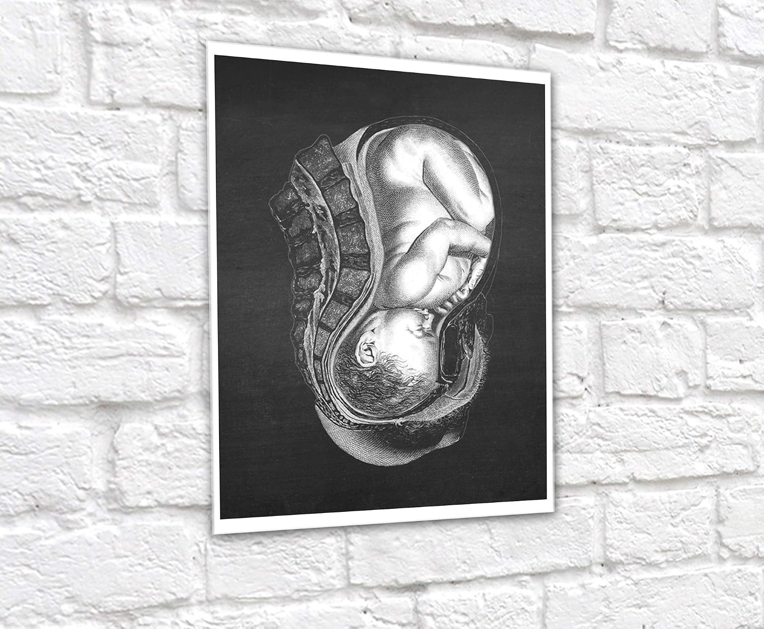 Gnosis Picture Archive Pregnancy Anatomy Art of Fetus Womb set of 3 unframed Medical Decor