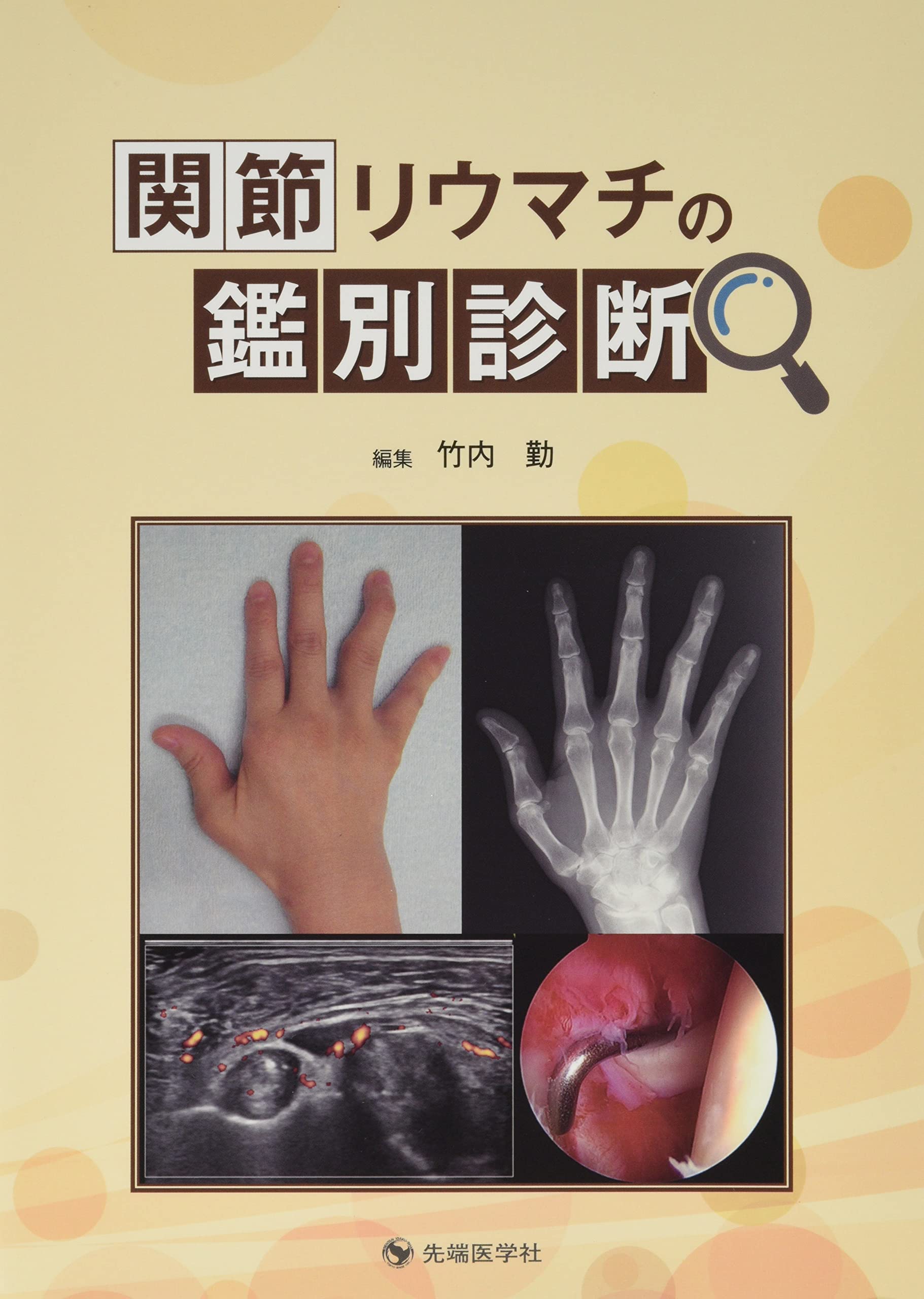 慢性関節リウマチの診断と治療ハンドブック   /メディカルレビュ-社（単行本） 61qI6ywVt7L._UF350,350_QL50_.jpg