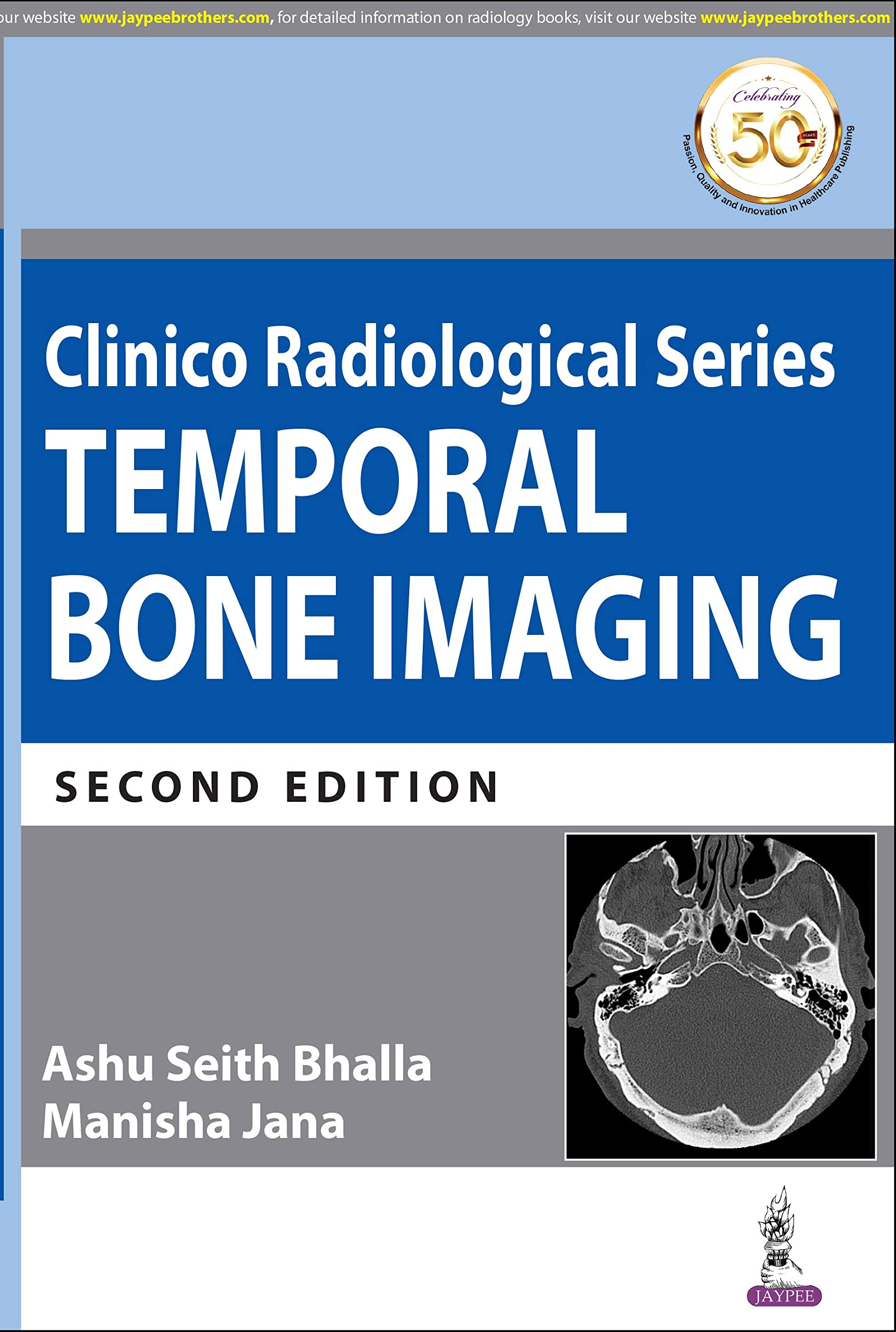 Buy Clinico Radiological Series: Temporal Bone Imaging Book