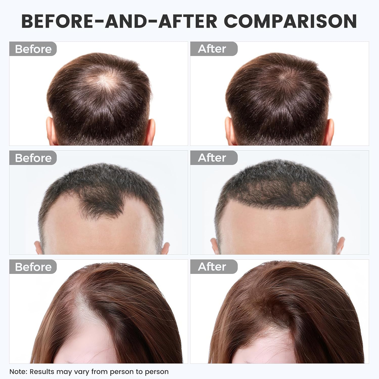 Red Light Therapy for Hair Growth: Cordless Red Light Heating Cap with 2000mAh Rechargeable Battery, Portable Care Tool for Home Use for Men & Women - Image 2