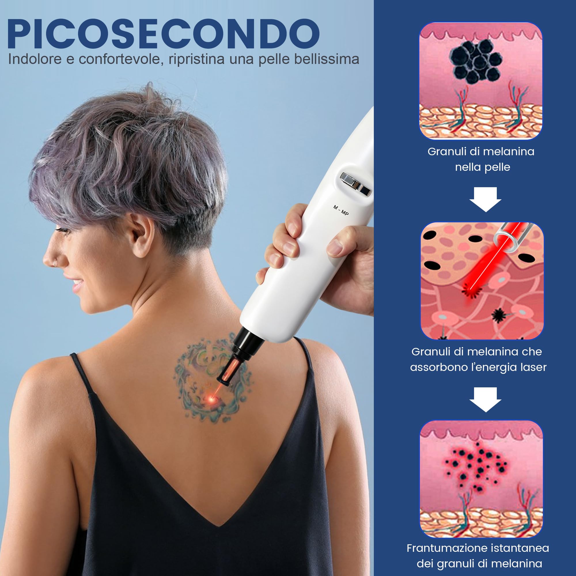 Picolaser Professionale 3 Lunghezze d'Onda per Tatuaggi e Macchie