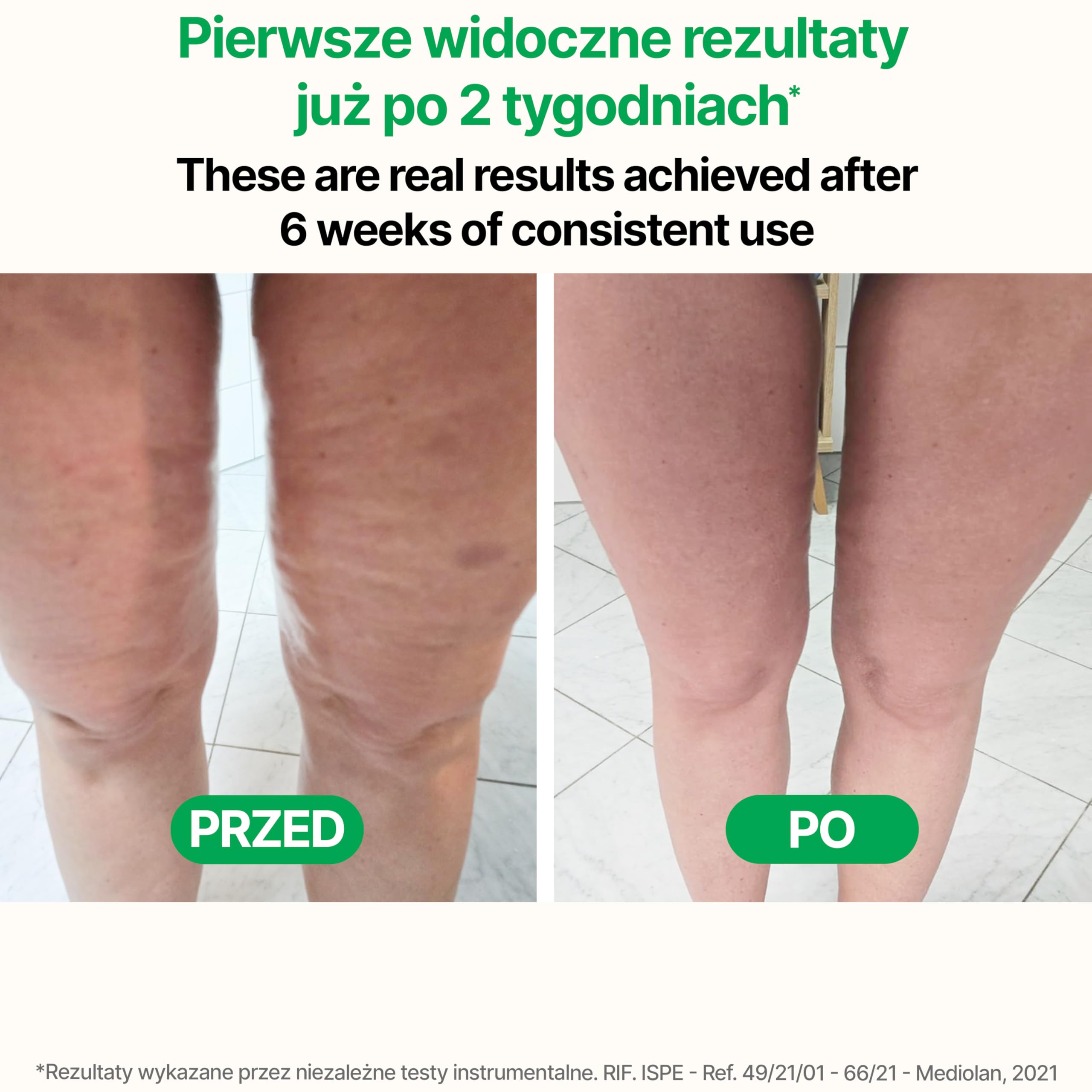 TESMED CELLULITE Ręczny opatentowany masażer antycellulitowy – masażer antycellulitowy i urządzenie ujędrniające skórę na nogi, pośladki i uda – Wyprodukowano we Włoszech