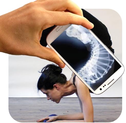 Advanced Body X Ray Scanner: Real-Time Medical Imaging