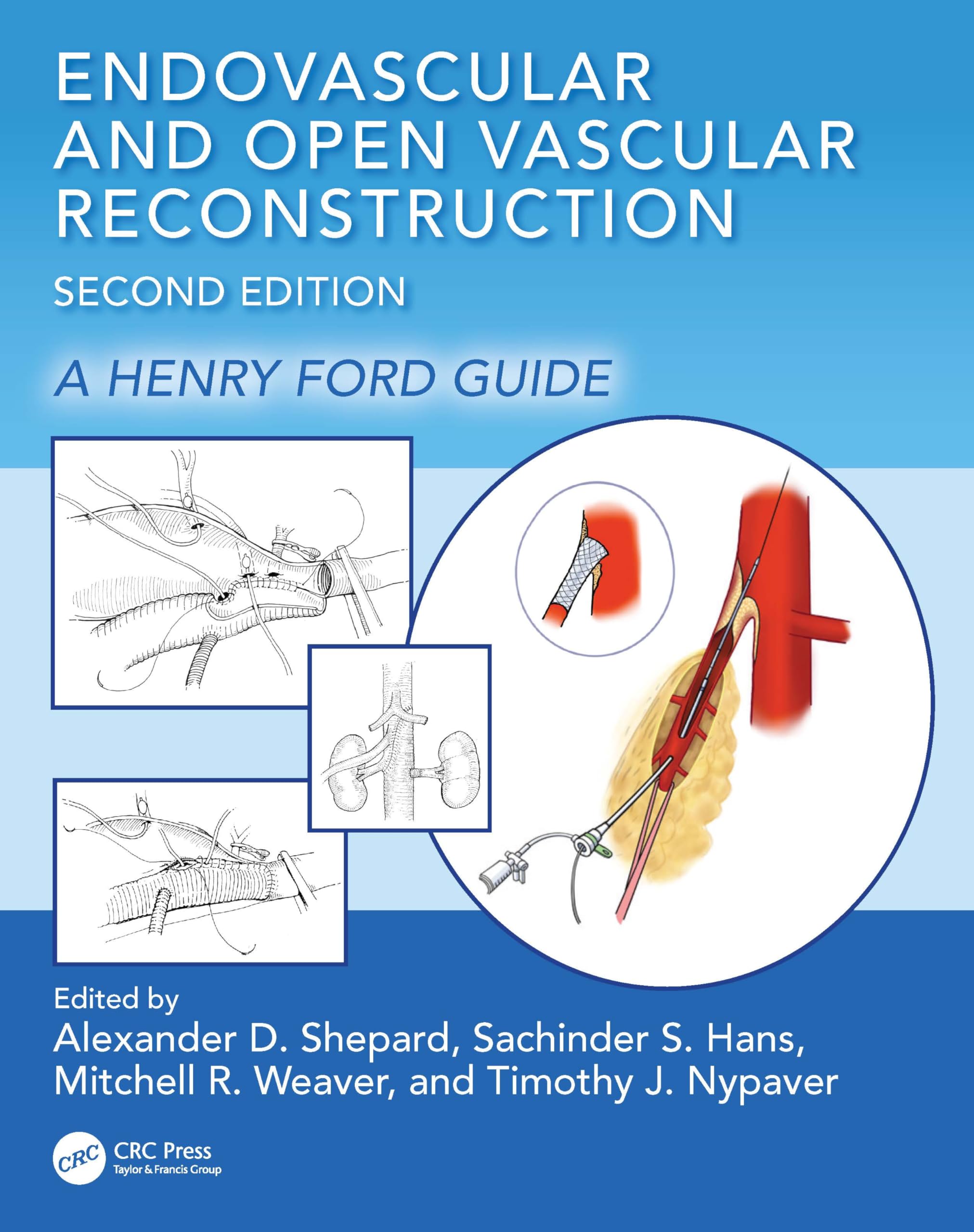 Endovascular and Open Vascular Reconstruction: A Henry Ford Surgical Guide