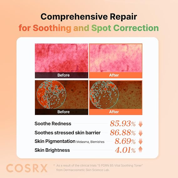 COSRX 5 PDRN B5 Vital Soothing Toner - Korean Toner for Rejuvenating & Soothing Skin with Salmon DNA, Centella, Lactobacillus PDRN & Panthenol, Korean Skin Care 9.46 fl.oz.