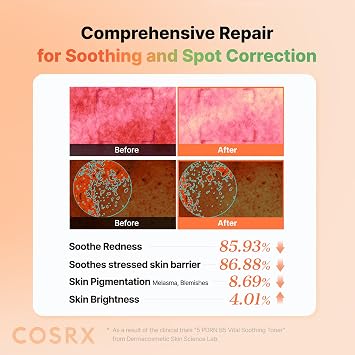 COSRX 5 PDRN B5 Vital Soothing Toner - Korean Toner for Rejuvenating & Soothing Skin with Salmon DNA, Centella, Lactobacillus PDRN & Panthenol, Korean Skin Care 9.46 fl.oz.