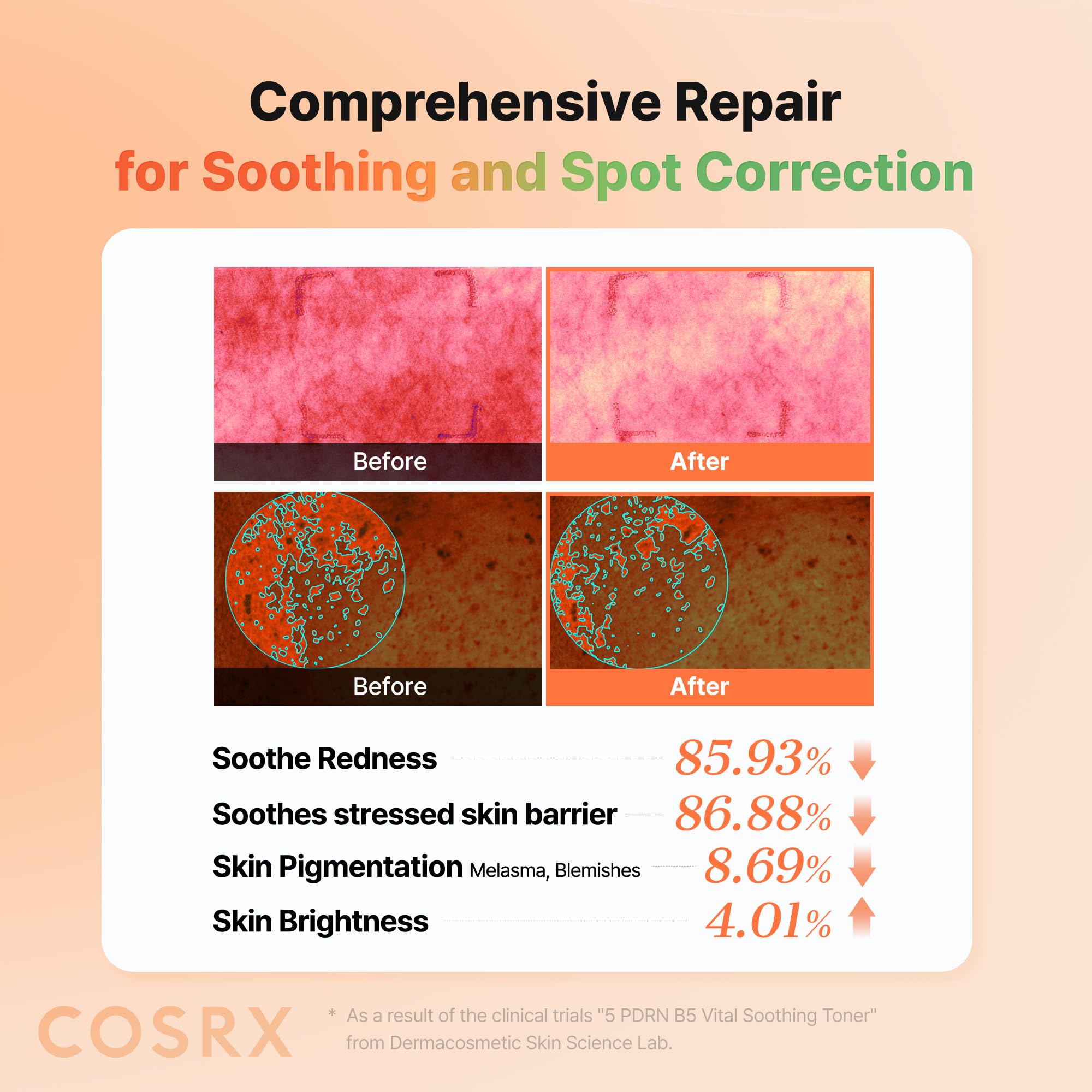 COSRX 5 PDRN B5 Vital Soothing Toner 280 ml – Cura della pelle coreana per la cura e la rivitalizzazione della pelle con DNA di salmone, Centella e Pantenolo