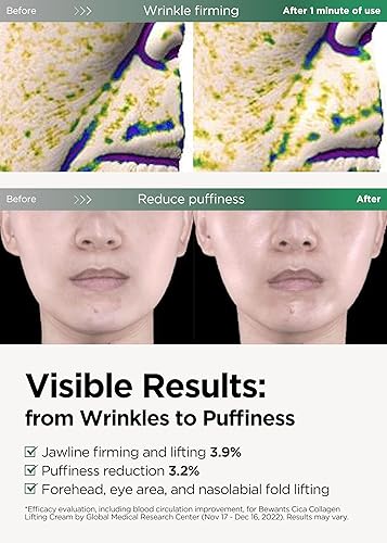 Miniatura 2 de BEWANTS Bewants Cica Collagen Lifting Cream (2 unidades)  Cuidado de arrugas de cuello y escote, crema de levantamiento facial instantáneo,