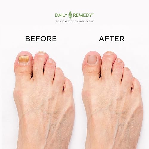 Miniatura 44 de Aceite de árbol de té para pies con sal de Epsom, fabricado en Estados Unidos, 16 onzas