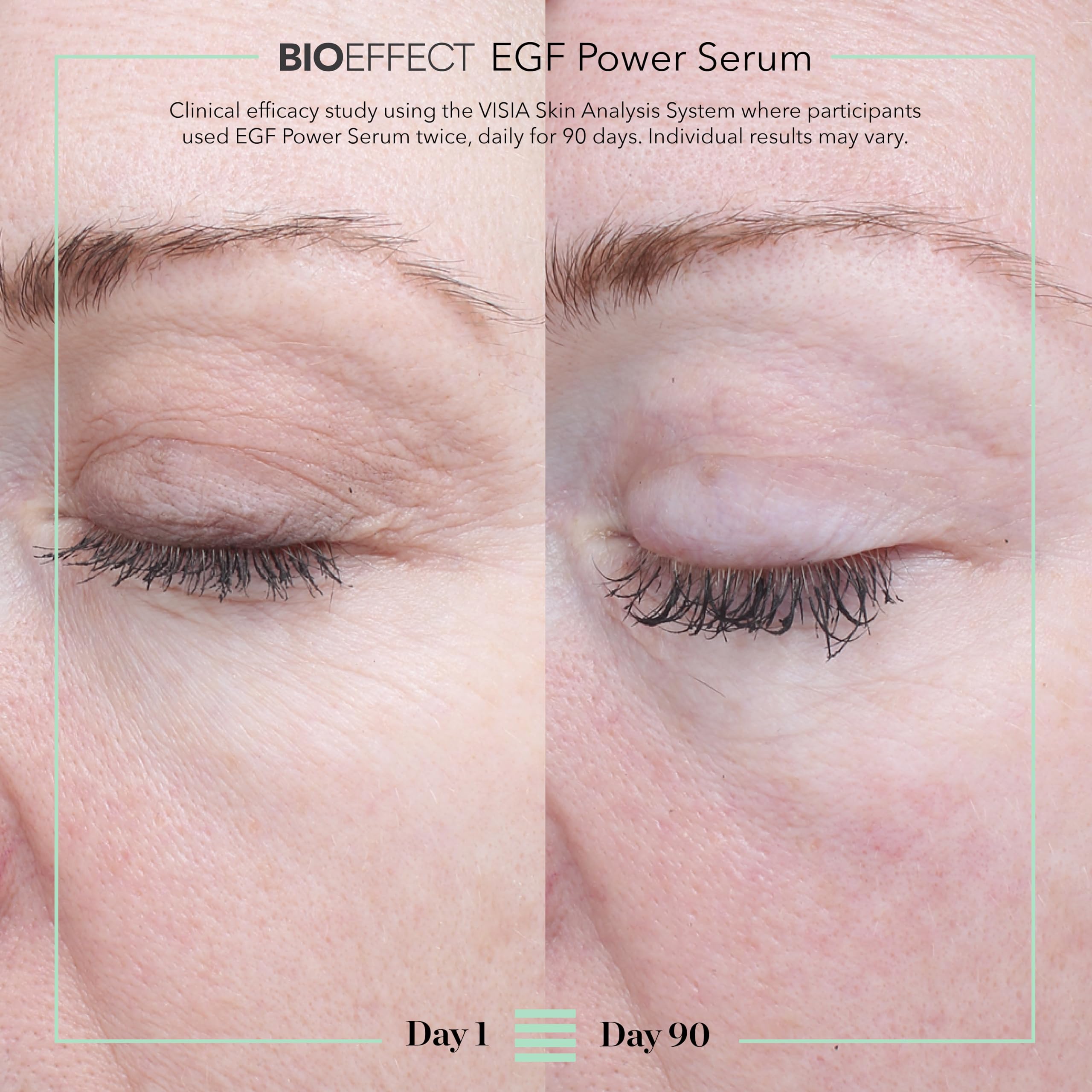 BIOEFFECT EGF Power Serum | Epidermal Growth Factor + KGF + Hyaluronic Acid | Intensive Age-Defying Face Treatment for Deep Wrinkles, Firmness & Skin Renewal, 15 mL / 0.50 oz