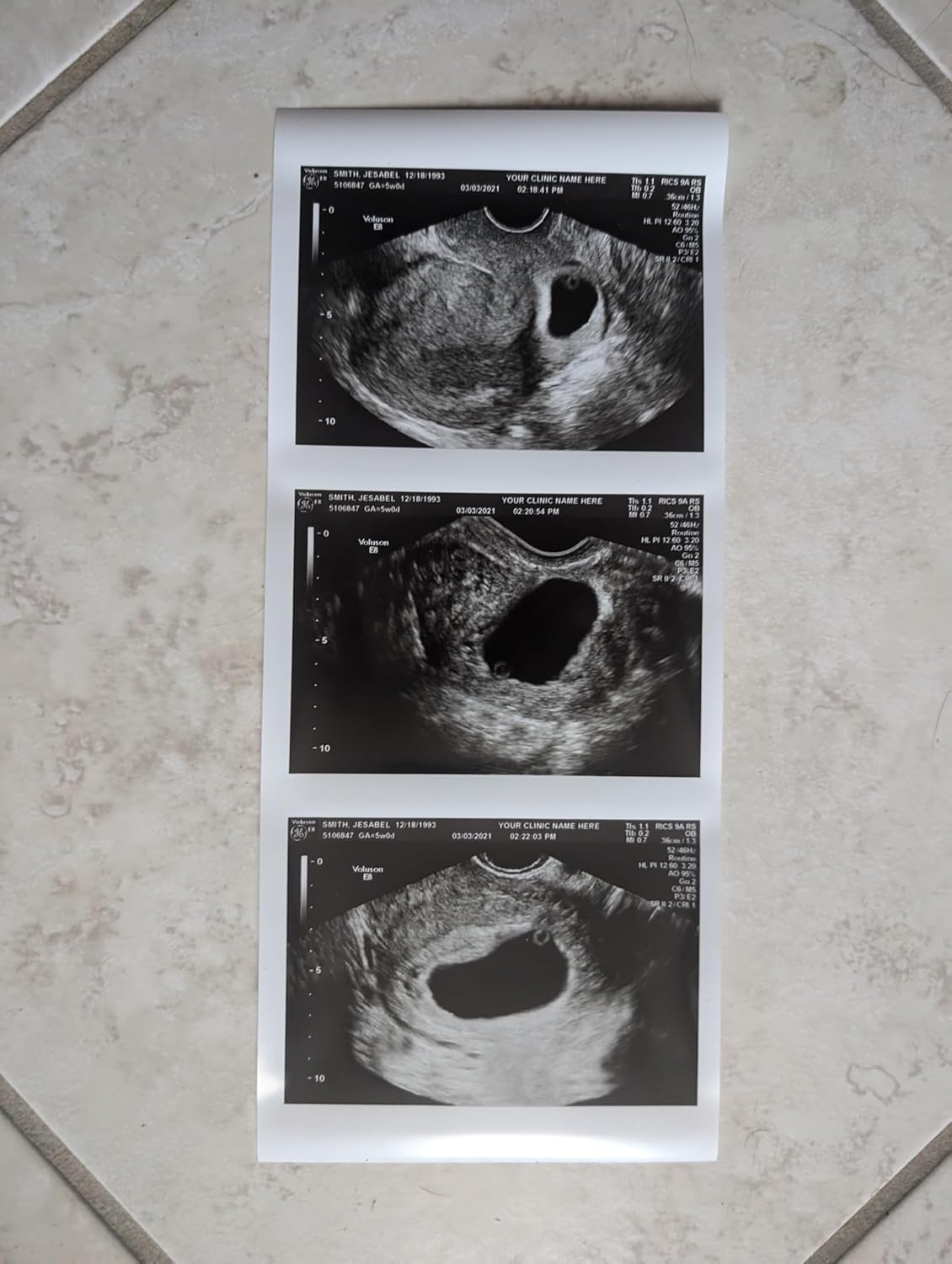 Prank 2D Customized Fake Ultrasound Strip of 3 Photos