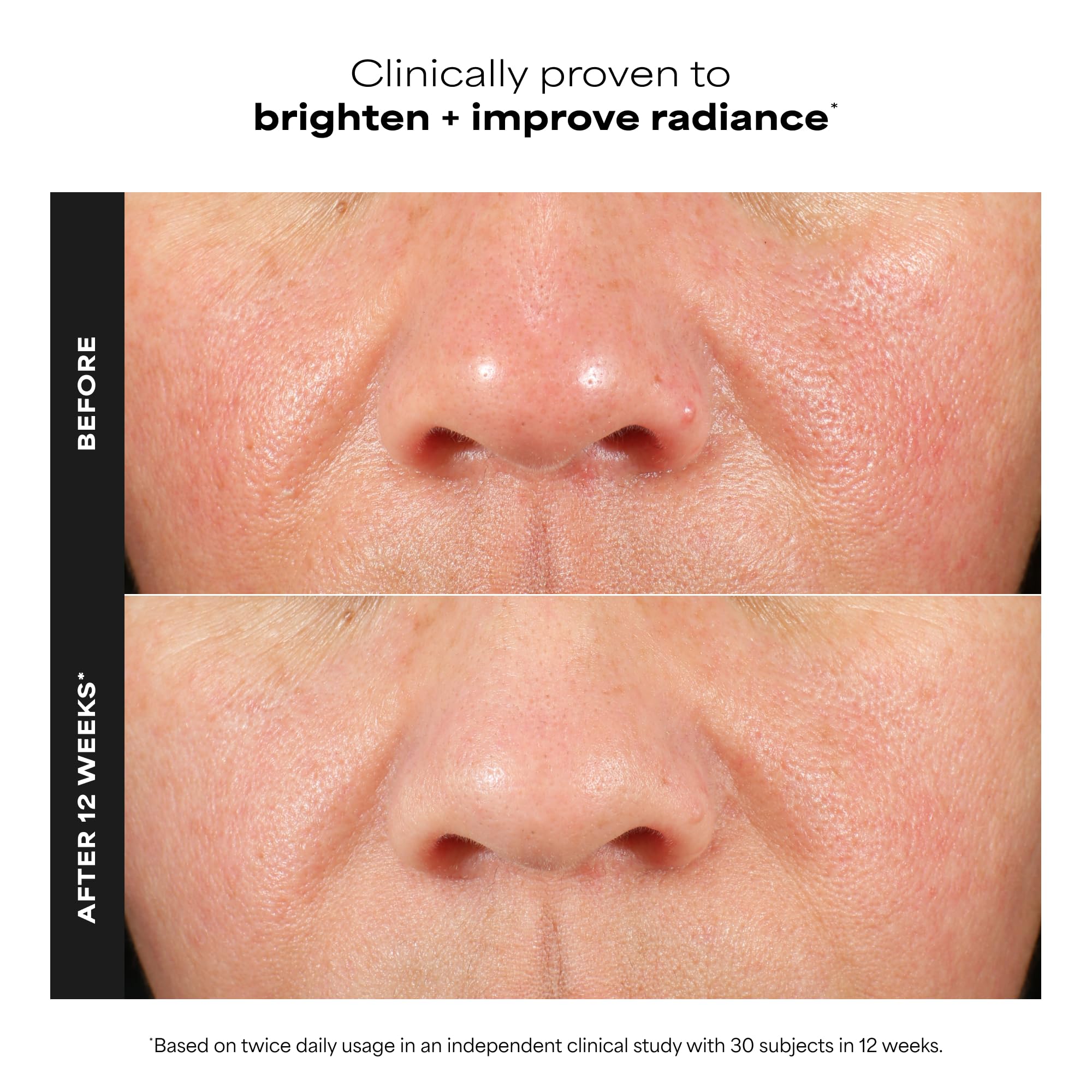 Paula's Choice C15 Witamina C Super BOOSTER - Serum przeciwstarzeniowe z 15% witaminą C - odciska brązowe plamy dla nudnej skóry - z kwasem ferolowym - Wszystkie rodzaje skóry - 20 ml