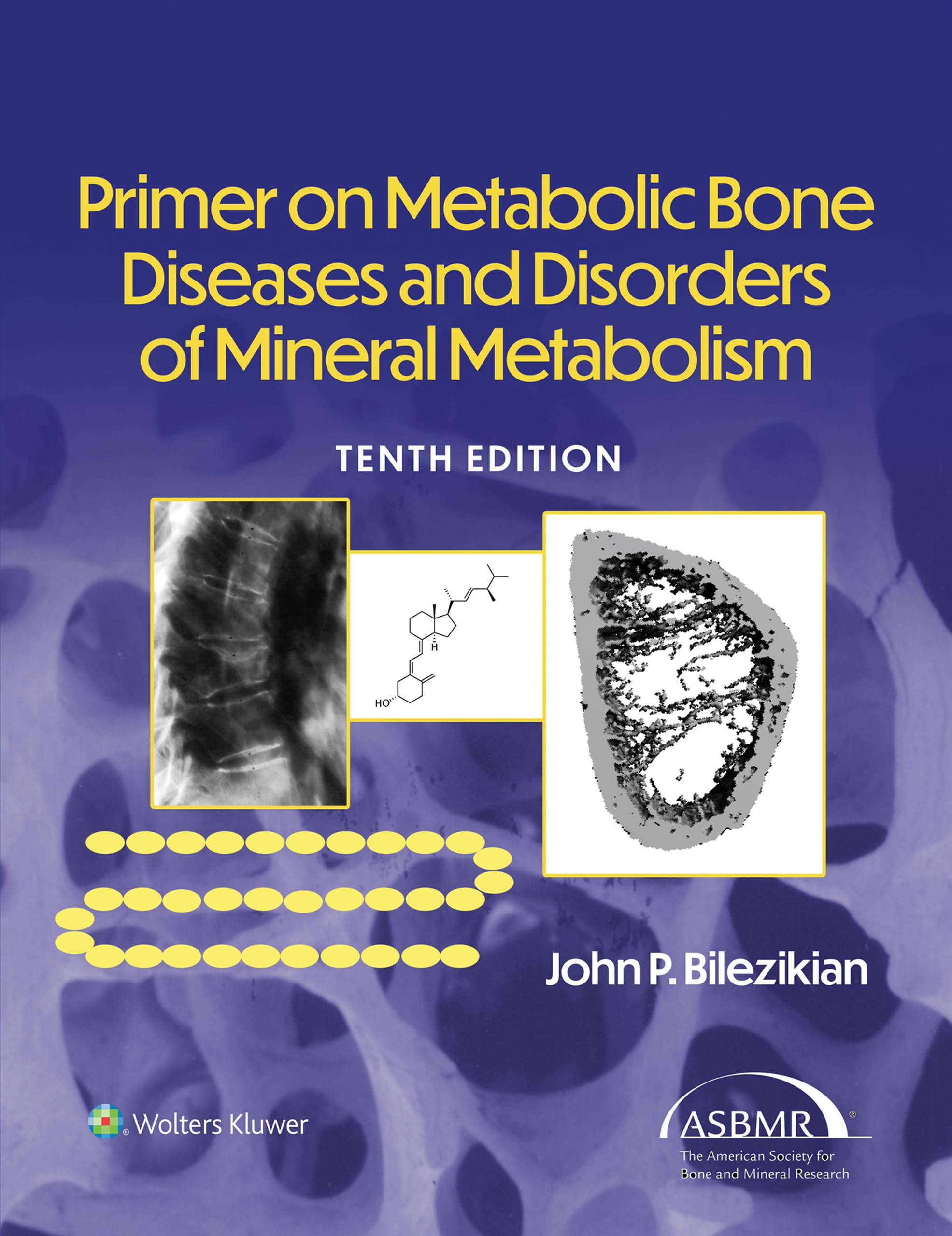 Primer on the Metabolic Bone Diseases and Disorders of Mineral Metabolism (English Edition)