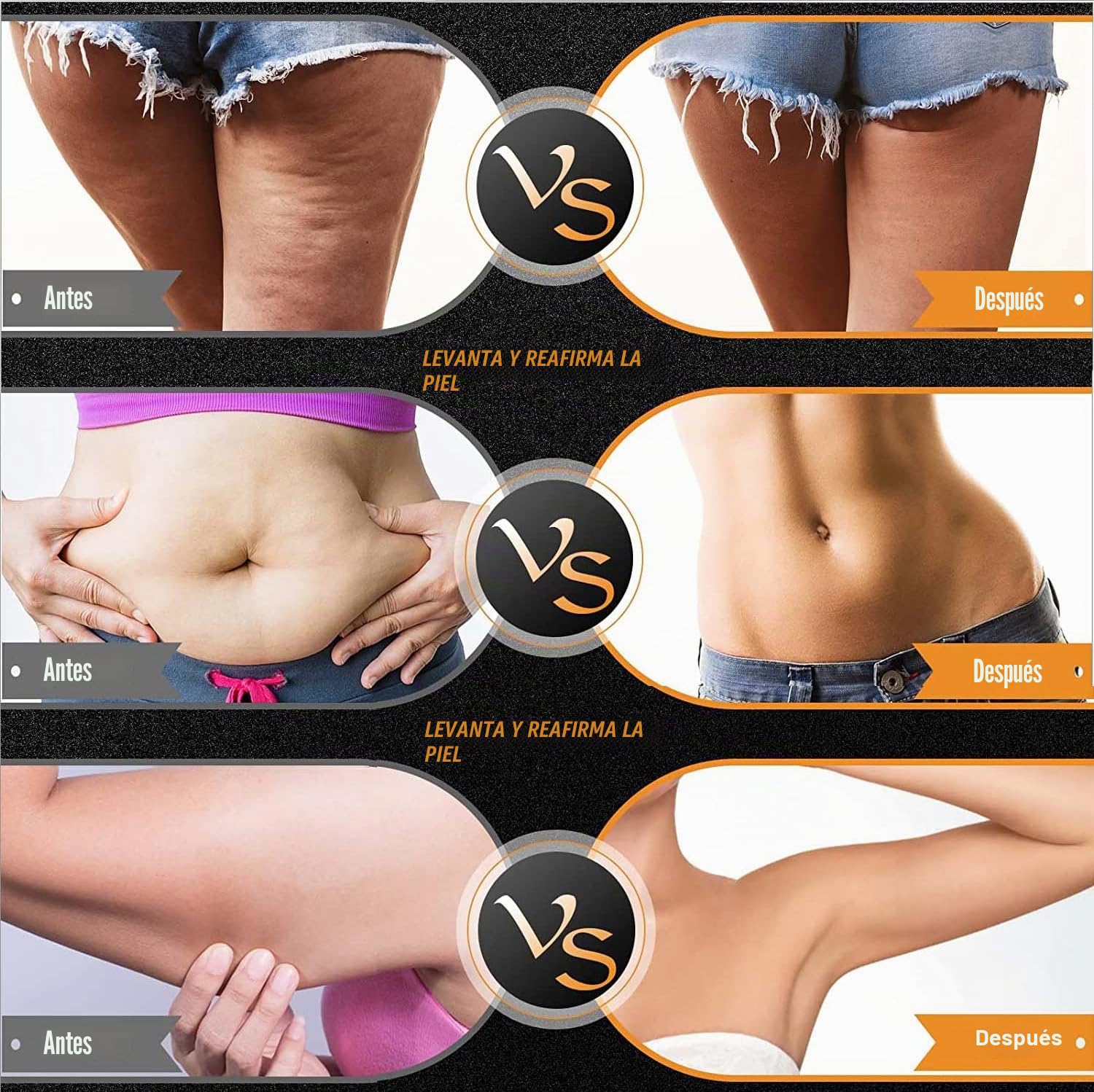 Elitzia Máquina facial de radiofrecuencia RF y EMS, uso doméstico, máquina de estiramiento de la piel, 3 tamaños, reemplazo de cabeza, levantamiento facial, reducción de arrugas, rejuvenecimiento de