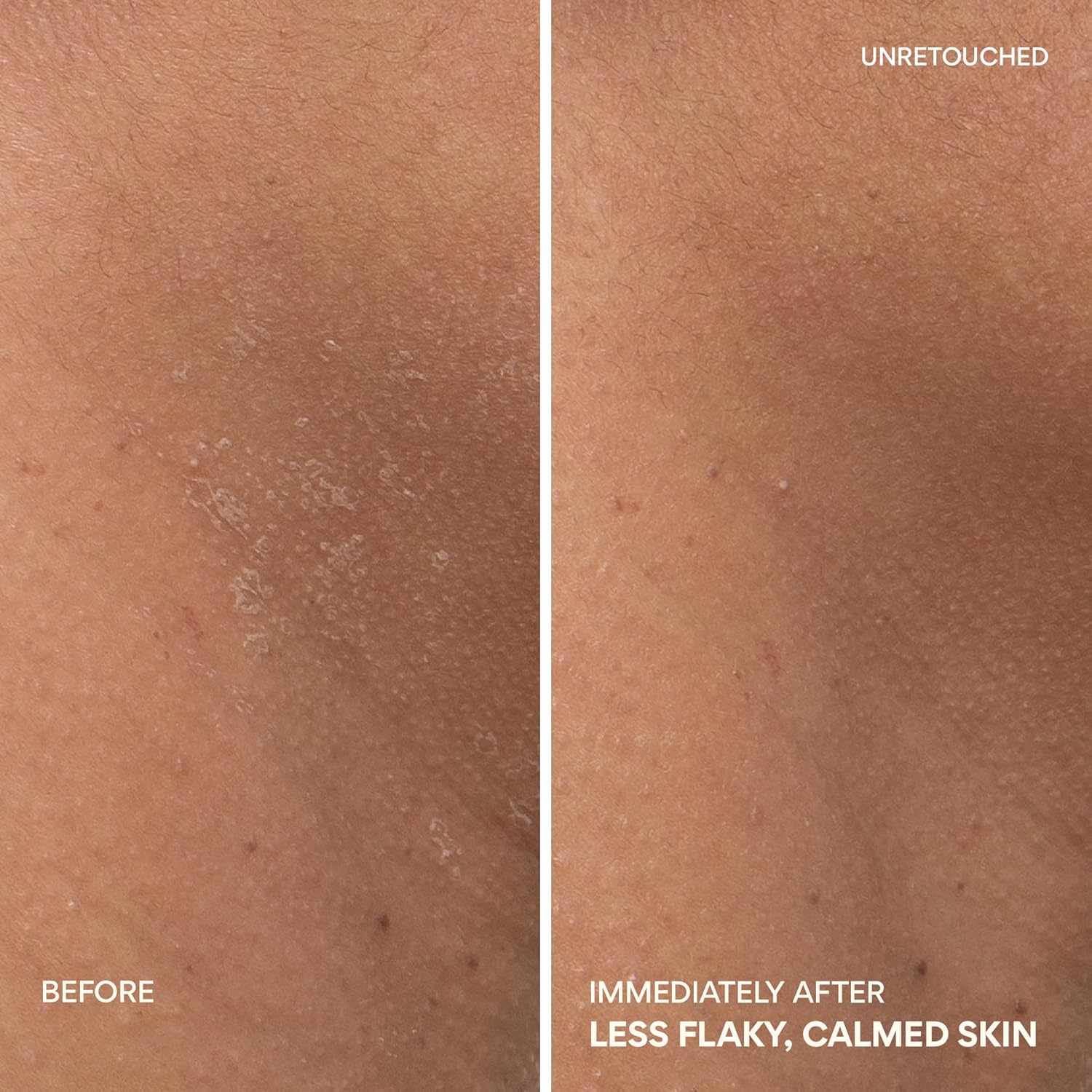 innisfree Green Tea Ceramide Cream, Hydrating Rescue Cream for Dry, Sensitive, and Eczema Prone Skin - Image 5