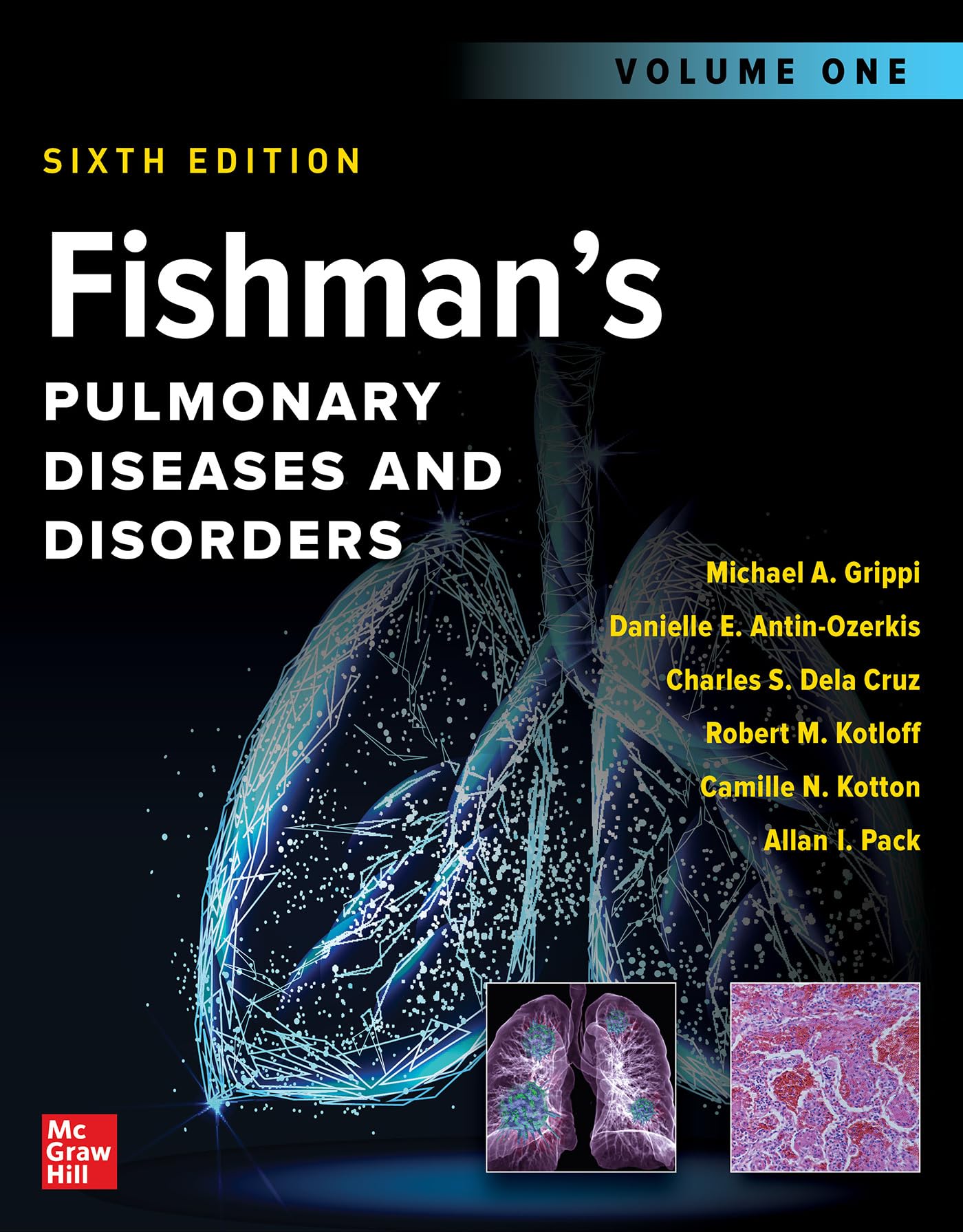 Fishmans Pulmonary Diseases and Disorders 6e (BUNDLE) Product Bundle – 18 Jan. 2023