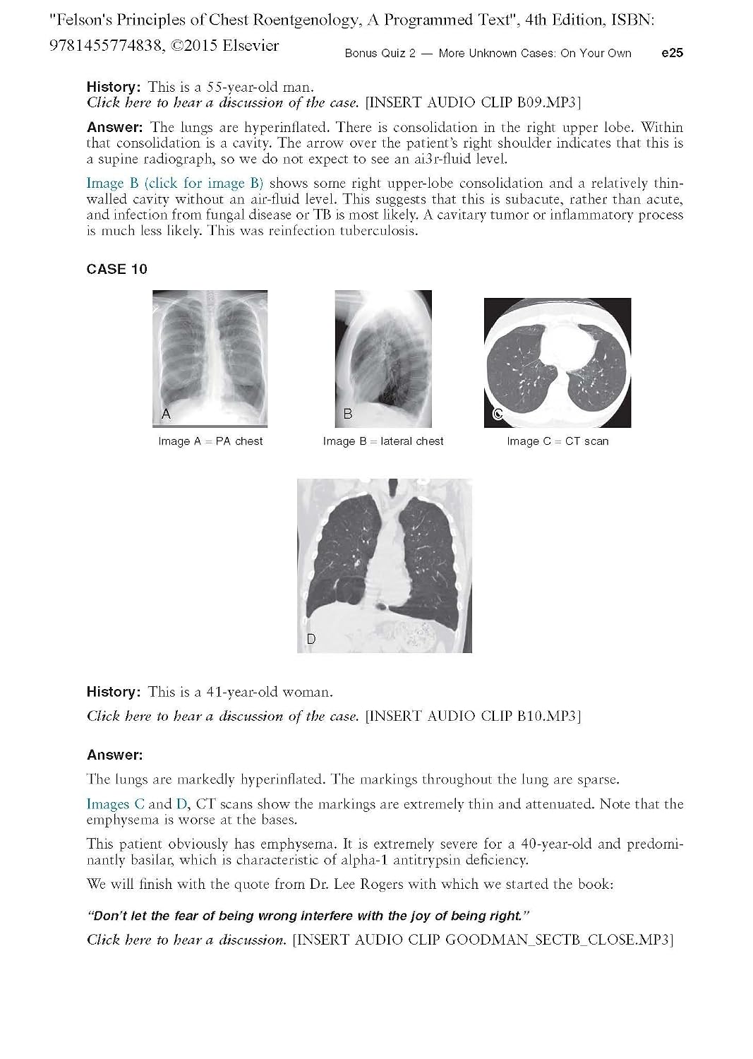 Felson's Principles of Chest Roentgenology, A Programmed Text