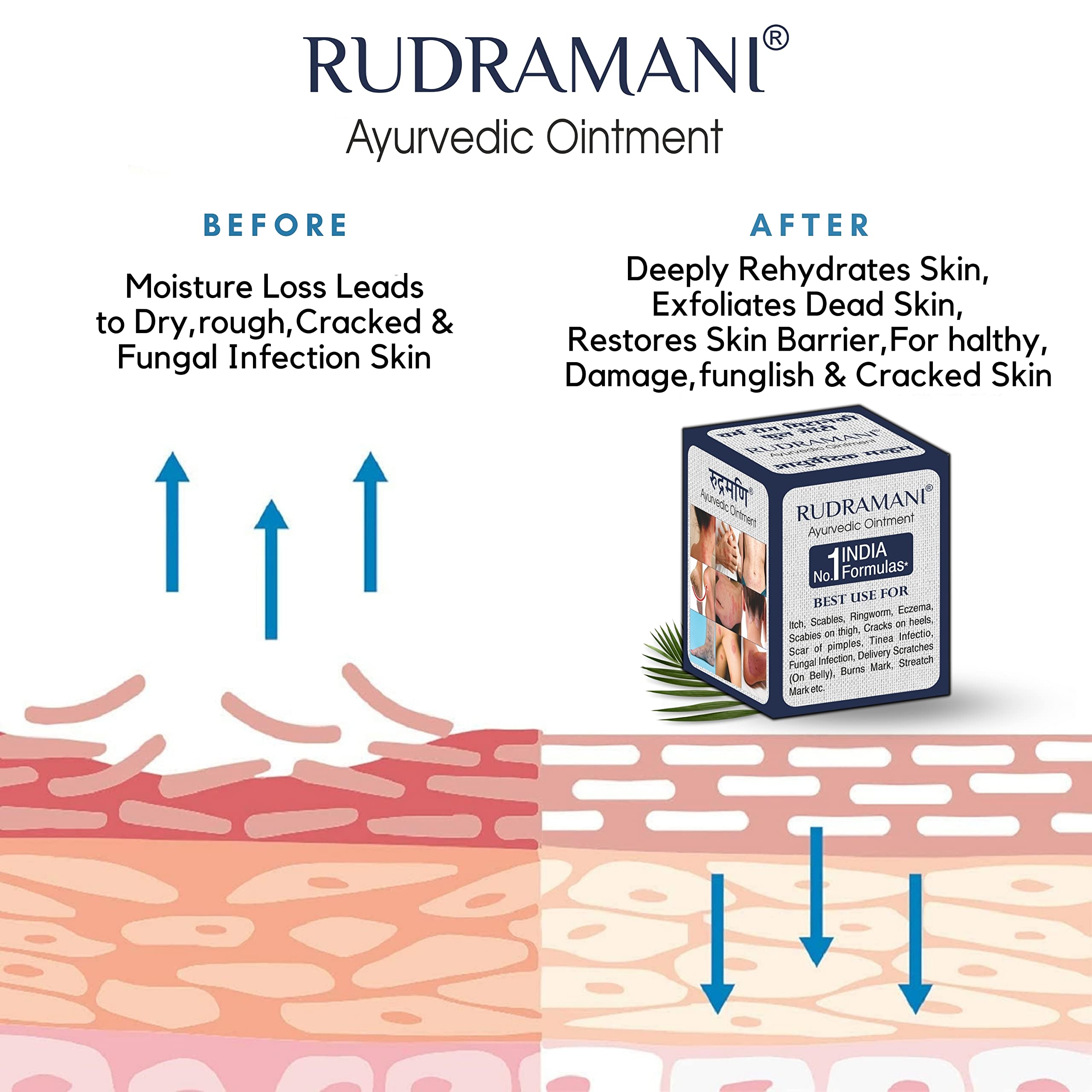 Rudramani Marham Malam Dad Khaj Khujli fungal Ointment - for Ringworm, itching & Skin Infection, Skin Tretment, Skin Care. (25GRAM) — Amazon image 2