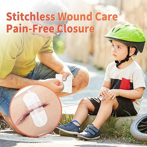 Miniatura 2 de RHINO RESCUE Dispositivo de cierre de heridas 6pcs, Tiras de cierre de heridas sin sutura para dispositivo de cuidado de cortes, vendajes adhesivos