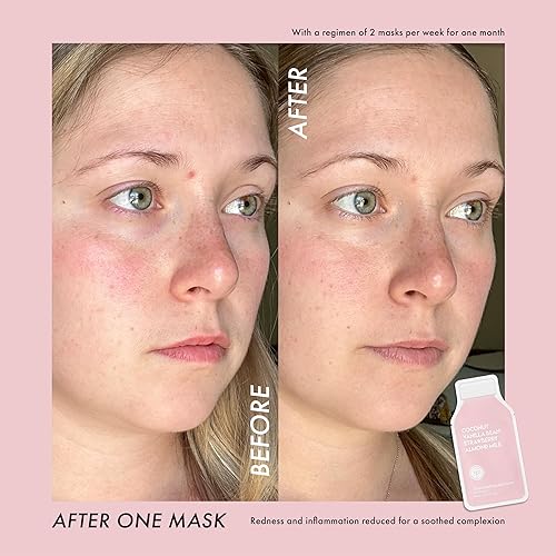 Miniatura 5 de ESW Beauty Mascarilla calmante de jugo crudo fresas y crema