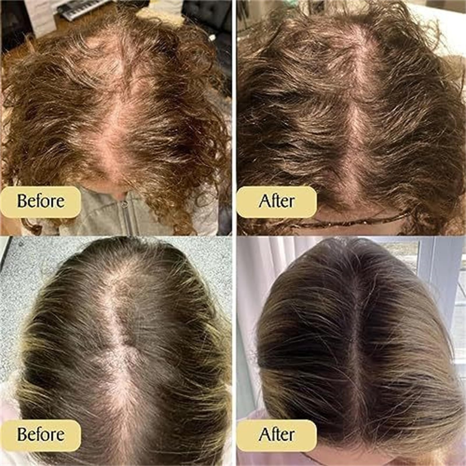 Teluni Carvenchy Haaröl Haarwachstum Öl mit Rosmarinöl für Haare Natürliche Haarkur Öl mit Argan Rizinus Mandelöl für trockene und geschädigte Haare