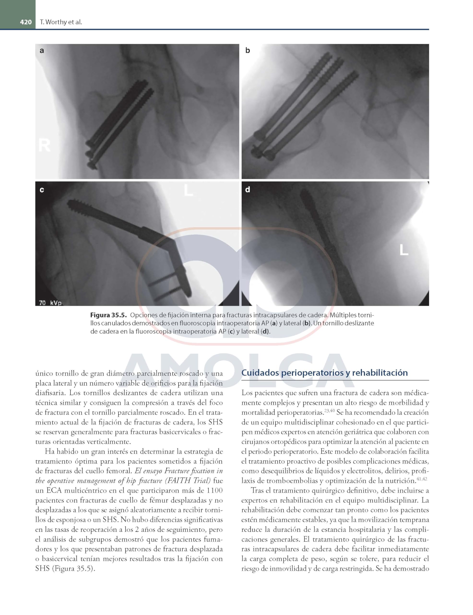ORTOPEDIA Y TRAUMATOLOGIA FUNDAMENTOS Y PRACTICAS OPTIMAS 3