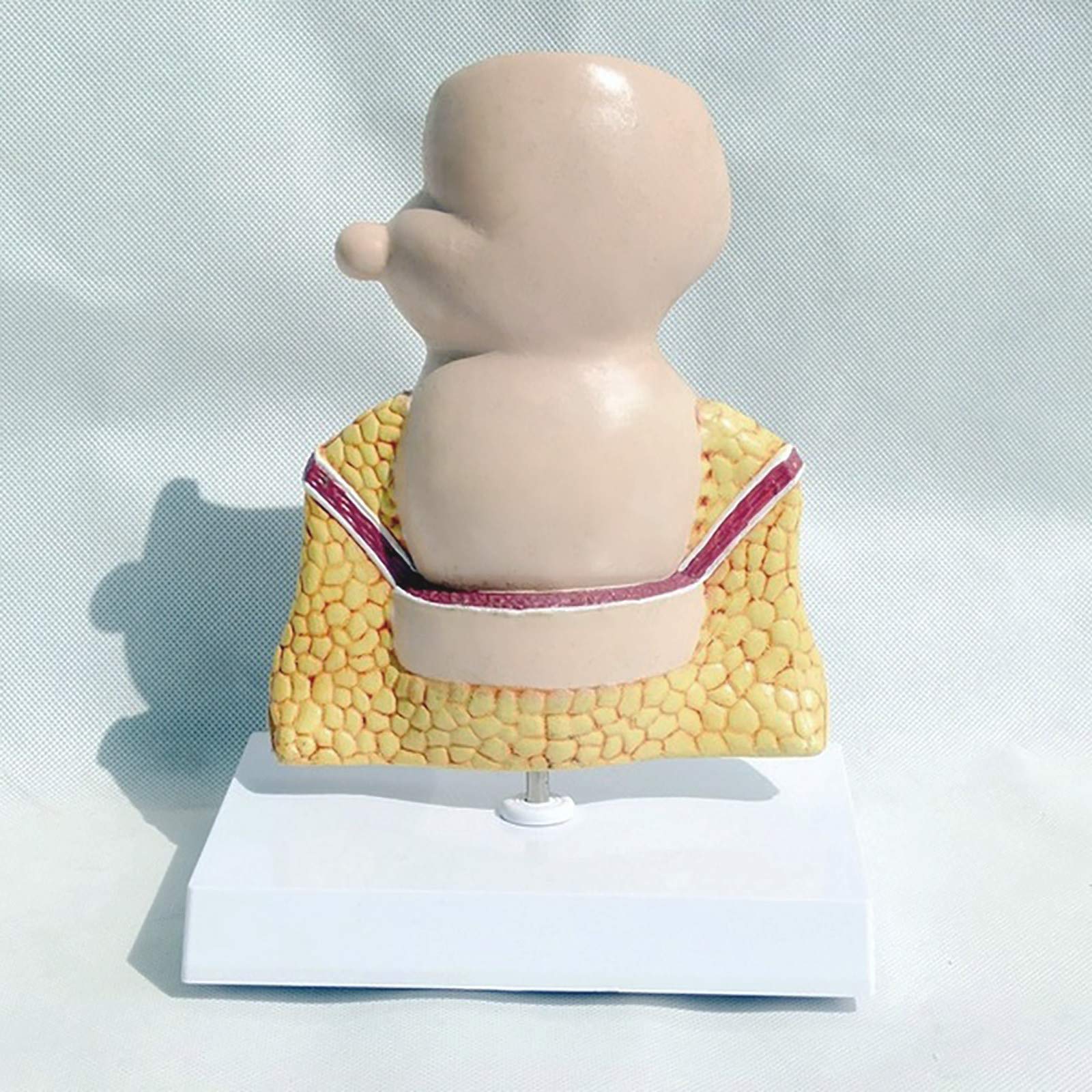 Modell Der Menschlichen Rektalen Pathologie, Modell Der Rektalen HäMorrhoidenpathologie, Modell Der Menschlichen Rektalen Anatomie, Medizinische Lehrmittel