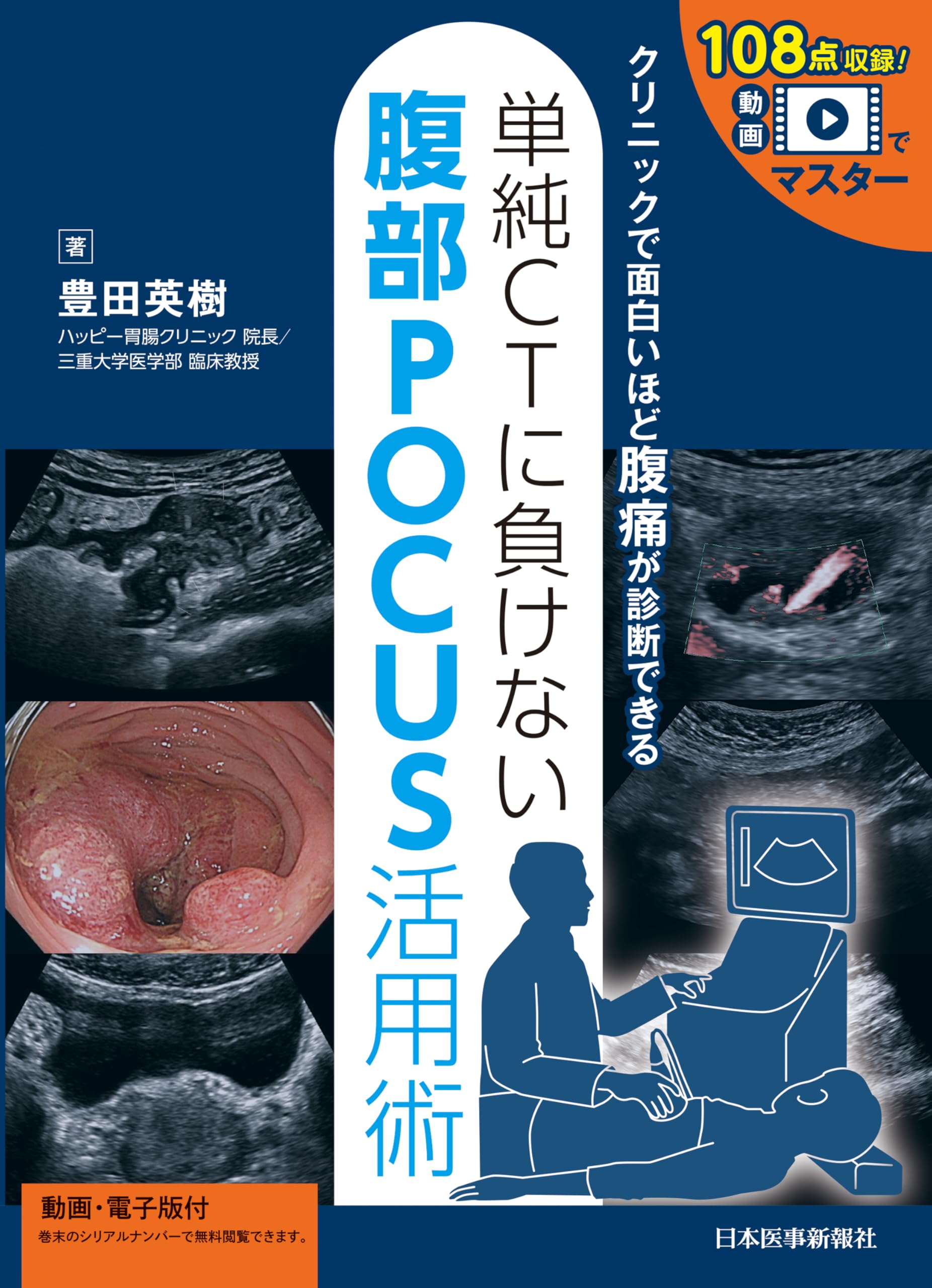 動画でマスター 単純CTに負けない 腹部POCUS活用術 | 豊田英樹 |本