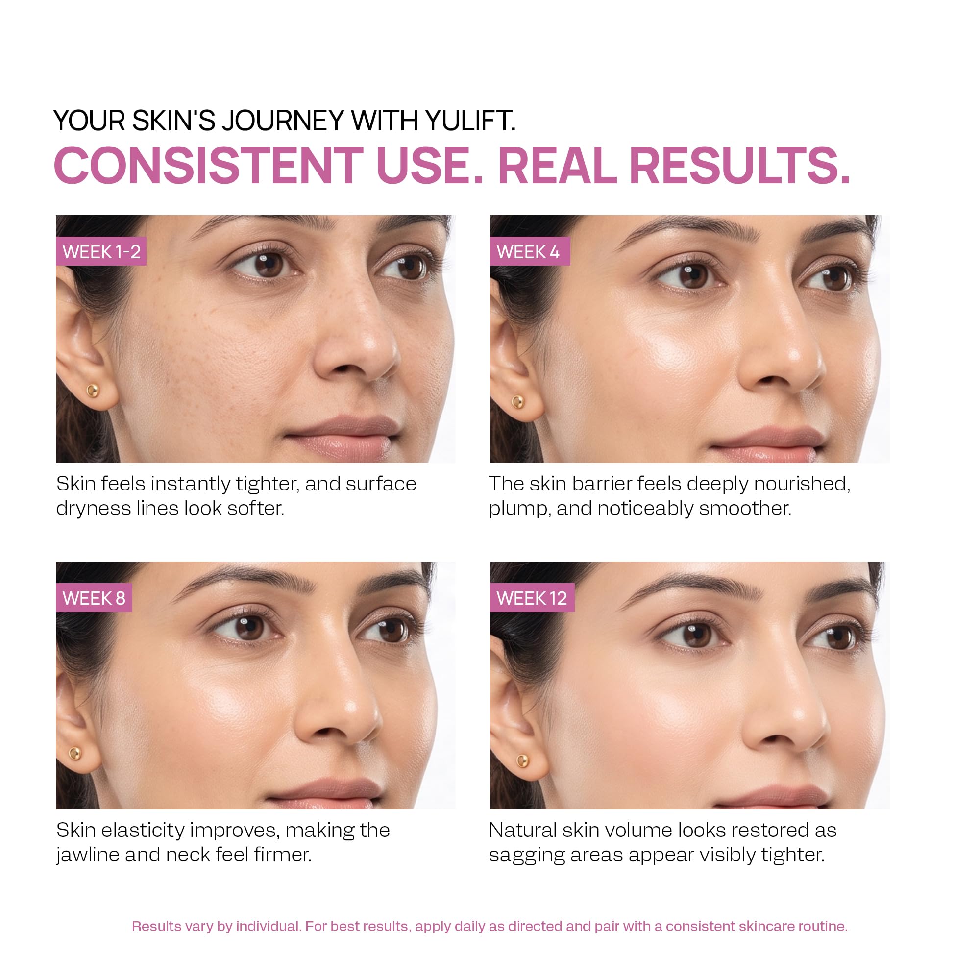 YUDERMA Yulift 3X Skin Firming Cream 100ml | With Instant Smooth & Tensor Effect | Helps Improve Skin Elasticity, Firmness & Texture | Face & Neck Cream for All Skin Types | Lightweight, Fast-Absorbing Formula 3