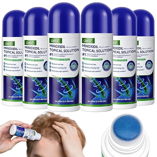 5% de minoxidil para mujeres y hombres, suero de crecimiento del cabello de minoxidil (infusión de biotina) con aplicador de esponja para adelgazar