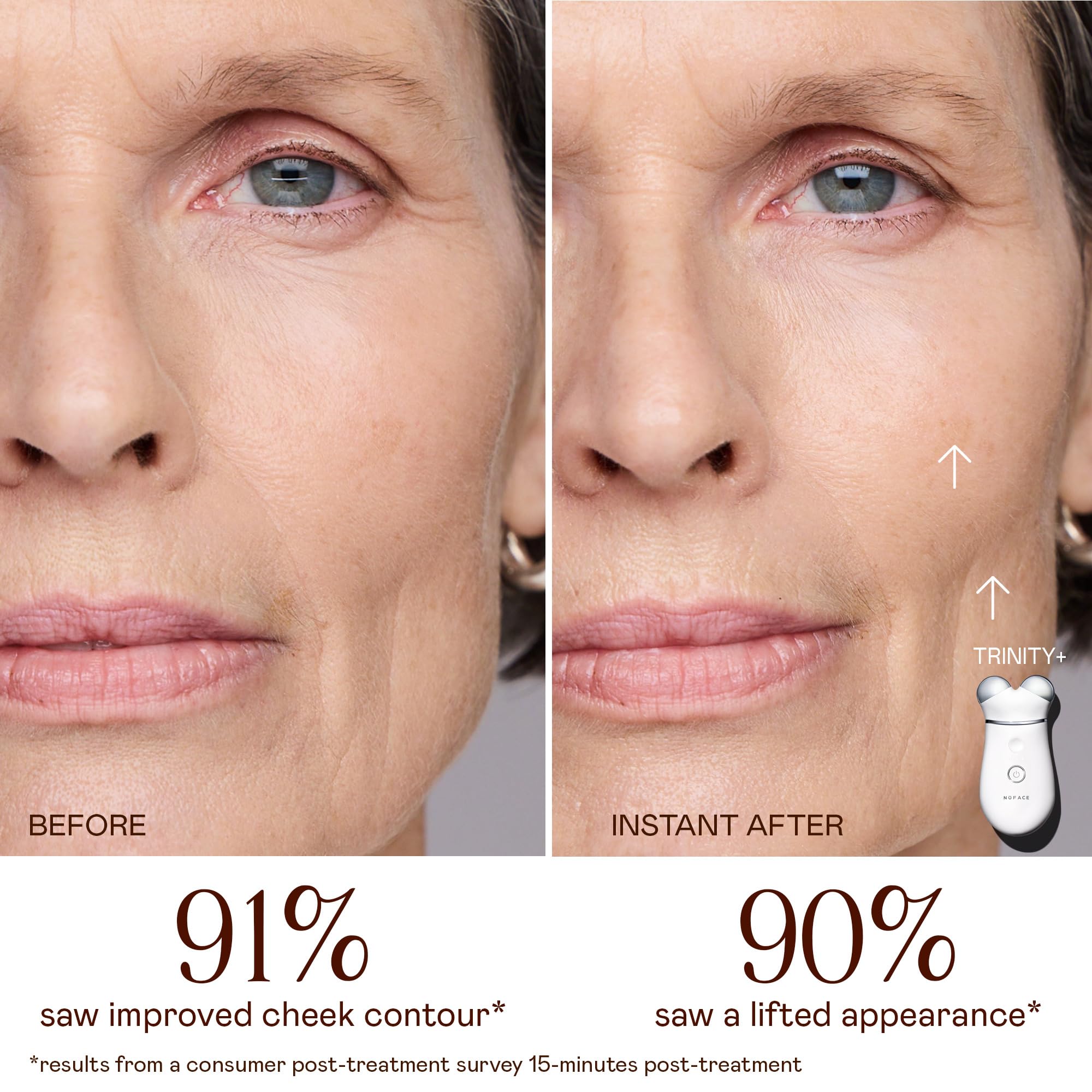 NuFACE Trinity+ Microcurrent Facial Device Kit - FDA Cleared Face