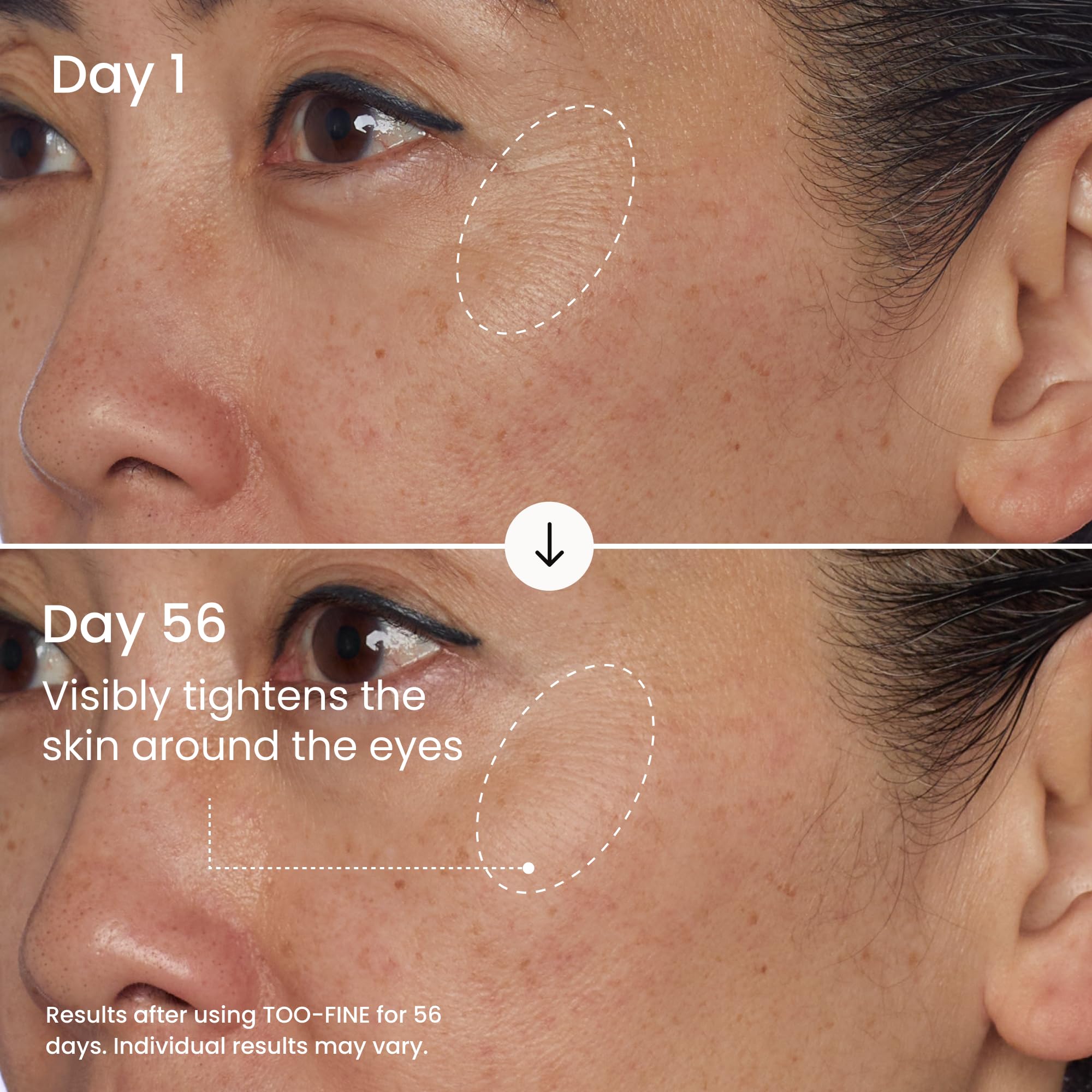 MAËLYS TOO-FINE Face Serum for Women - Firming Anti-Aging Serum with Glaucine & Bacillus Ferment - Helps Lift the Look of Sagging Skin on Jawline, Cheekbones & Under Eyes (15 mL)