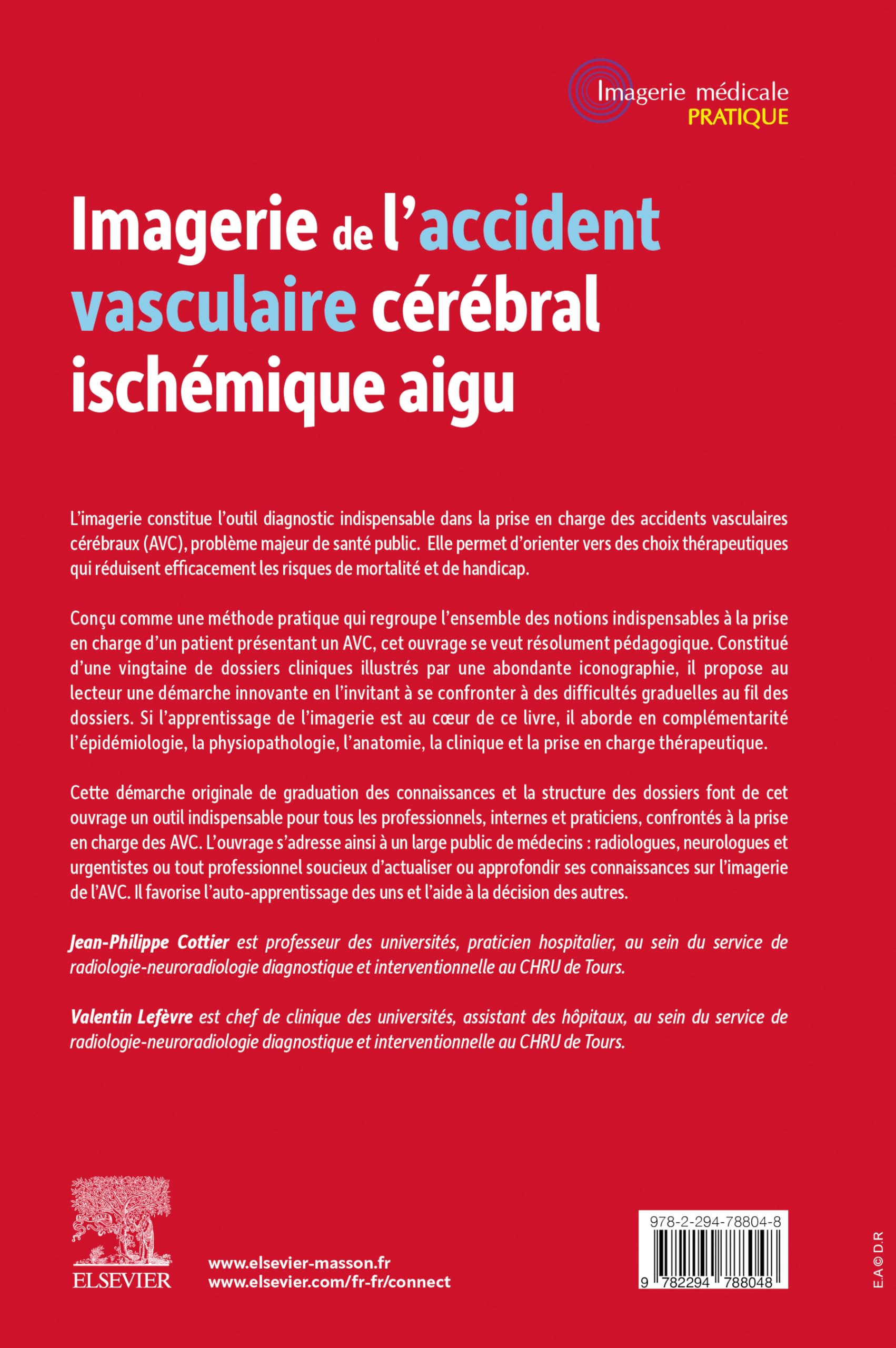 Imagerie de l'accident vasculaire cérébral ischémique aigu: Méthode d'auto-apprentissage